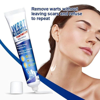 Wart Remover Cream
